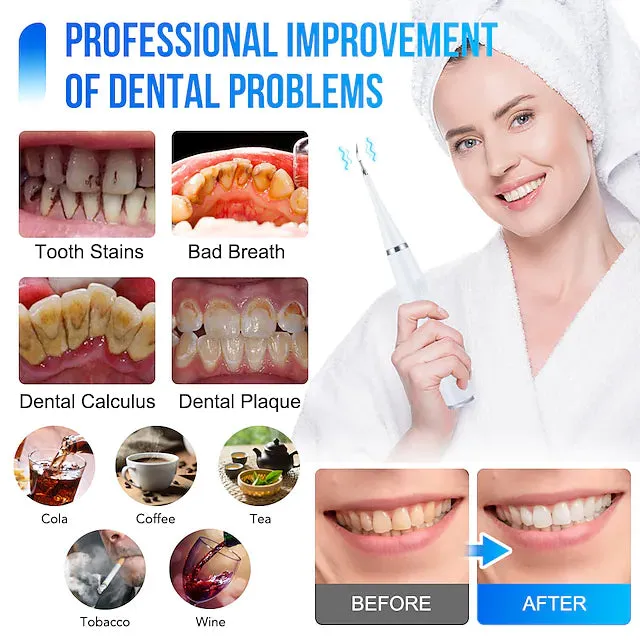 Electric Toothbrush Sonic Dental Scaler Teeth Whitening Kit
