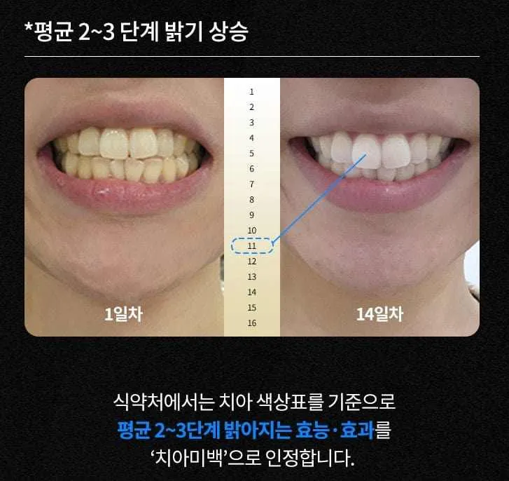 Ister14 D Intensive Whitening Gel