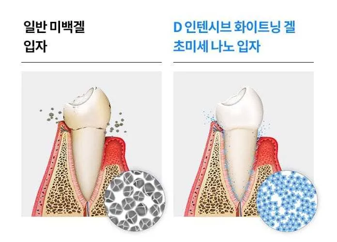 Ister14 D Intensive Whitening Gel