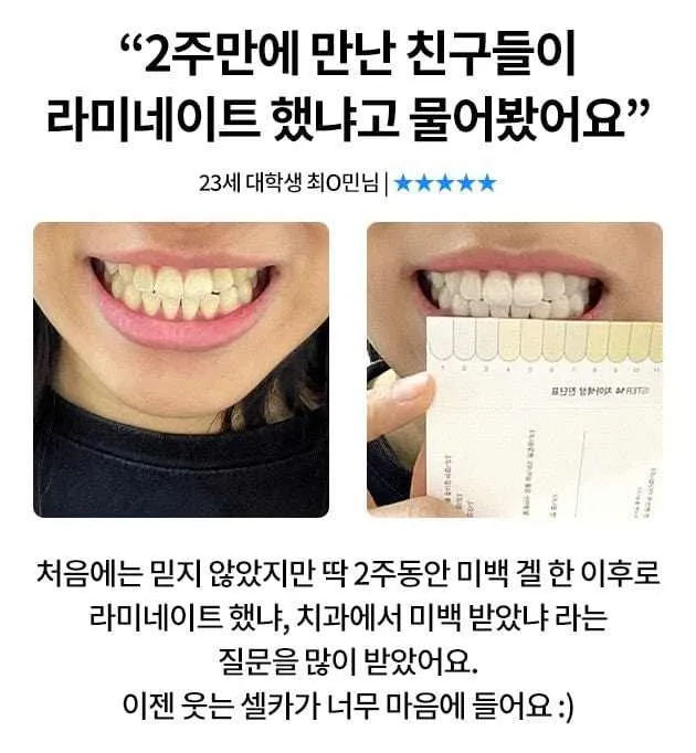 Ister14 D Intensive Whitening Gel