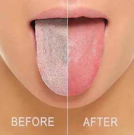 Tongue Scraper Cleaner